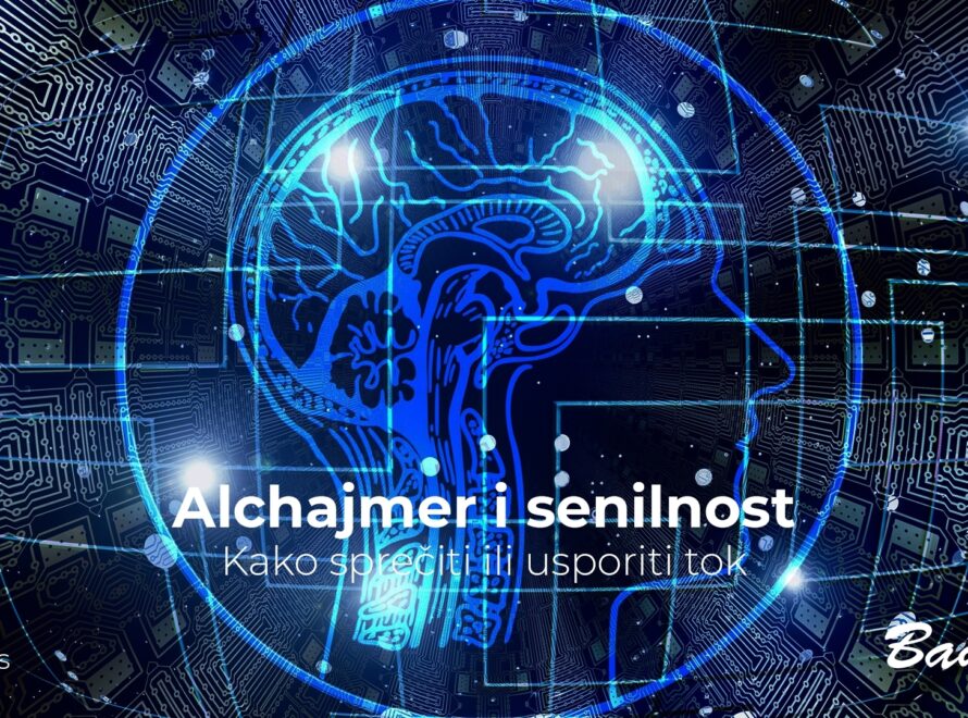 Alchajmer i senilnost
