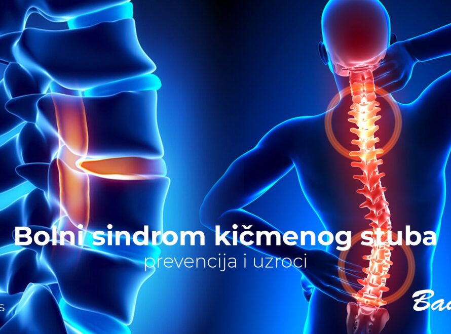 Bolni sindrom kičmenog stuba, prevencija i uzroci