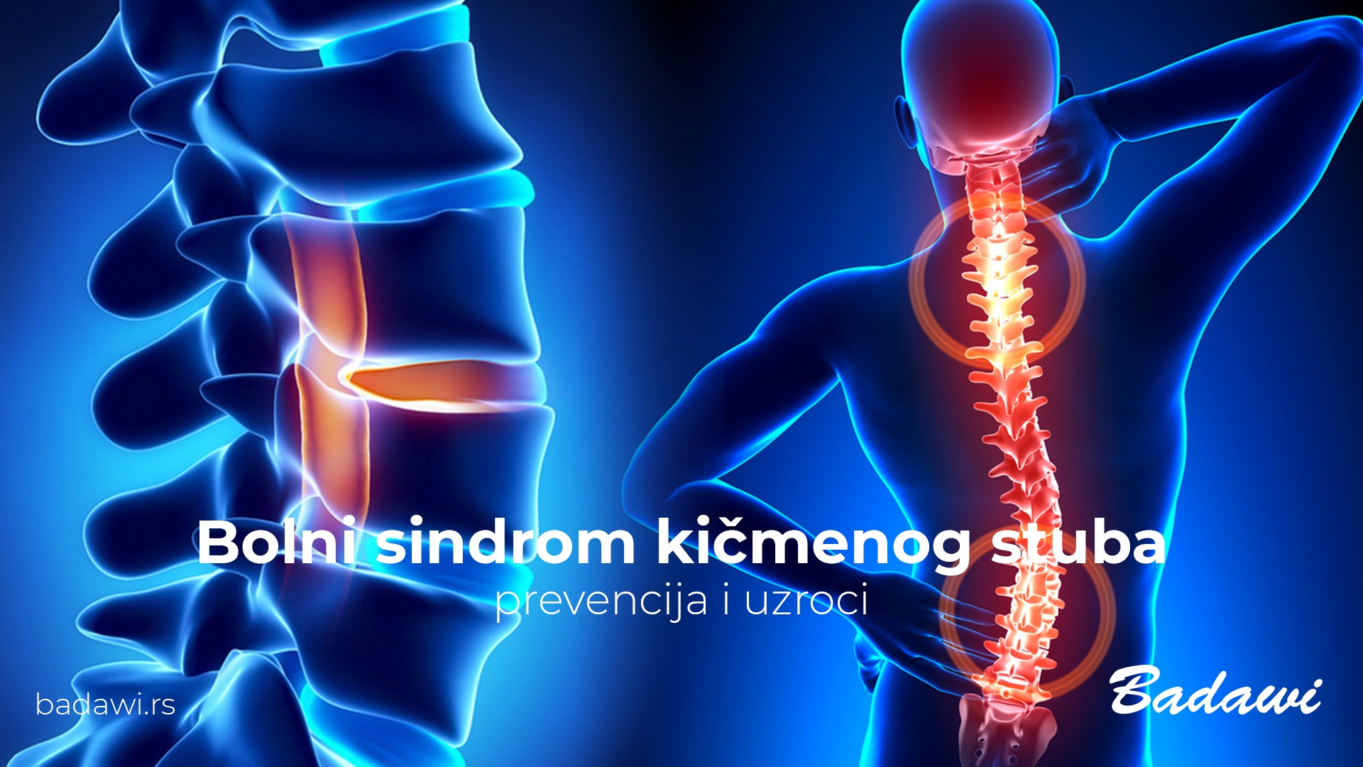 Bolni sindrom kičmenog stuba, prevencija i uzroci