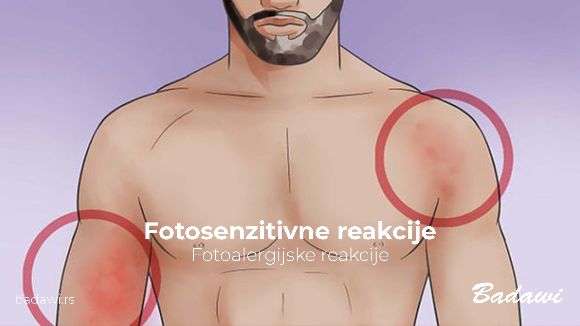 Fotosenzitivne reakcije