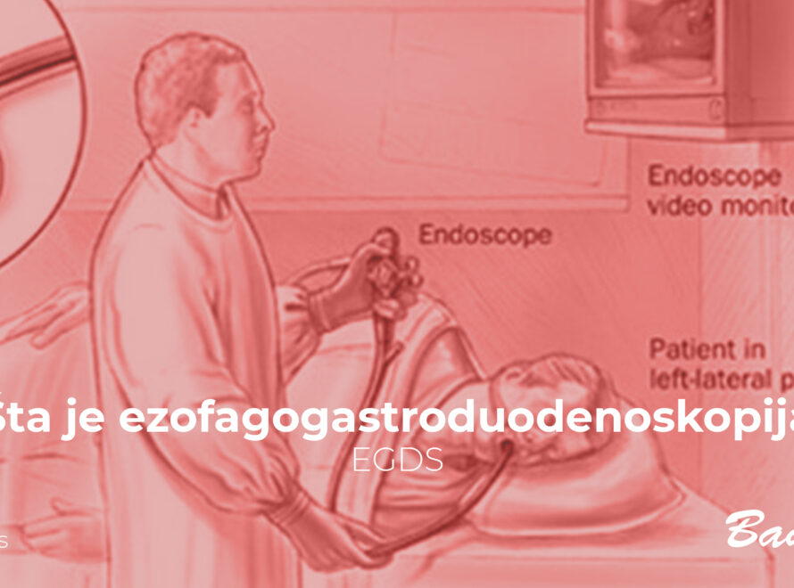 Šta je ezofagogastroduodenoskopija – EGDS?