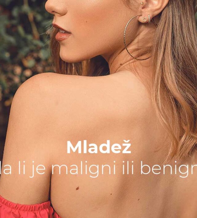 Mladež, da li je maligni ili benigni