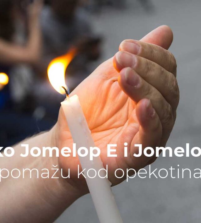 Kako Jomelop E i Jomelop G pomažu kod opekotina