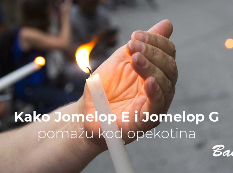 Kako Jomelop E i Jomelop G pomažu kod opekotina