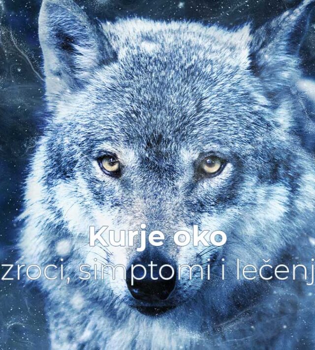 Kurje oko – uzroci, simptomi i lečenje